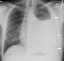 Screen Shot 2017-06-18 at 10.00.09 PM